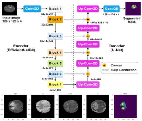 A Hybrid Multiclass Brain Tumor Segmentation Method Combining EfficientNet and U-Net