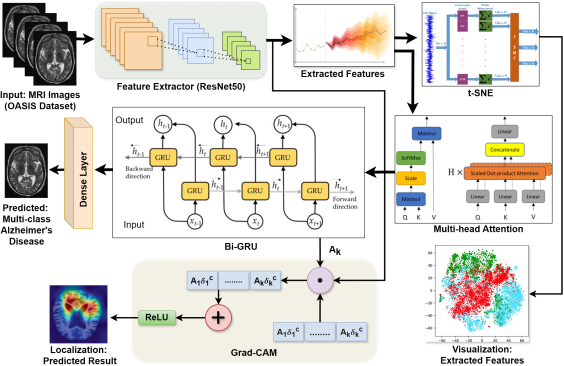 Multi-Stage Alzheimer’s Disease Prediction Using Multihead Attention based CNN-BiGRU with XAI